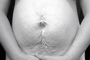 Kobiece ciało po porodzie
