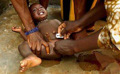 Obrzezanie dziewczynek - krwawa tradycja silniejsza od granic